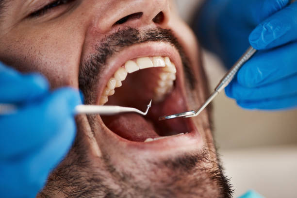 Best Pediatric Emergency Dentist in Pecan Plantation, TX
